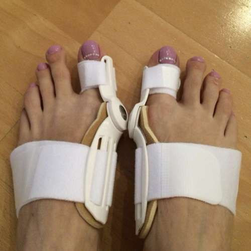 Bunion korrektor - 2 db. Malatec 21948